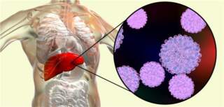 Hepatitis B: Importance of Awareness and Treatment Options