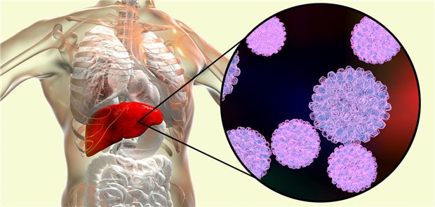 Hepatitis B: Importance of Awareness and Treatment Options