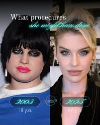 The Evolution of Kelly Osbourne: From Reality Star to Advocate