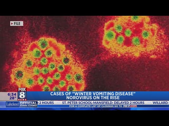 The Rising Concern of Norovirus Winter Vomiting Disease 2023