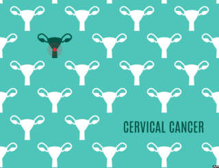 The Vital Role of Cancer Screening in Healthcare