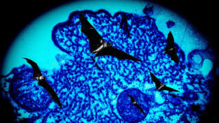 Understanding the Nipah Virus Outbreak in 2023