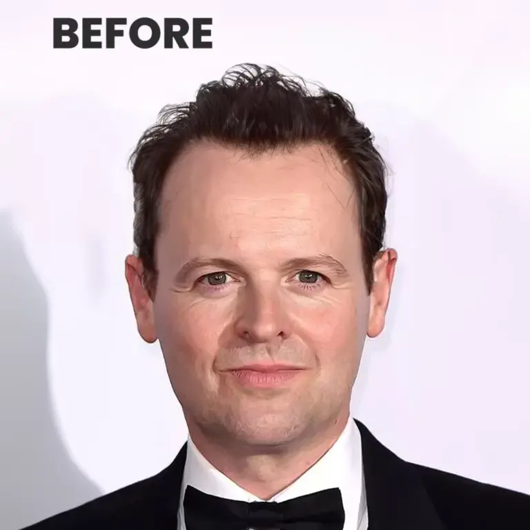 The Rise of Declan Donnelly: A Prominent Figure in TV