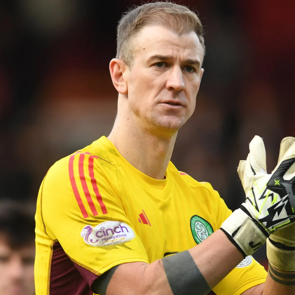 Why Joe Hart’s Legacy in Goalkeeping Still Matters Today
