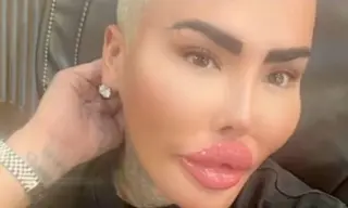 Tragic Death of ‘The Lip King’: What We Know