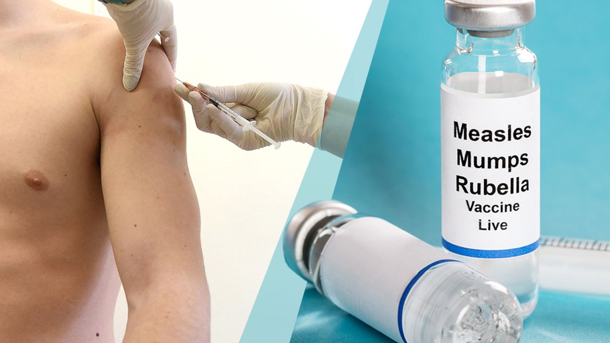 The 2023 Measles Outbreak: Understanding the Risks