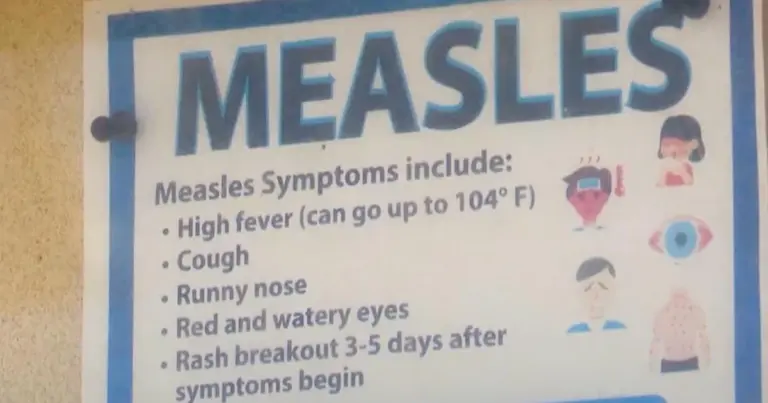 Recognising Measles Symptoms: What You Need to Know