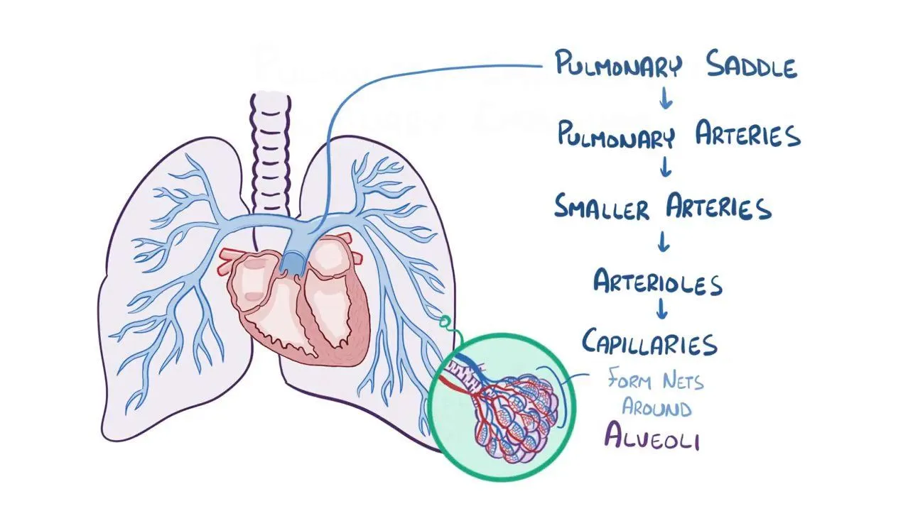Understanding Pulmonary Embolism and Its Impact on Health
