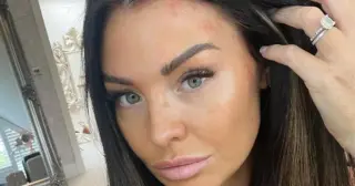 Jess Wright Faces Backlash Over Thong Bikini Comments