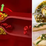 Cholesterol: Pharmaceutical Companies Bet on ‘s Lesser-Known Form, Lp(a)