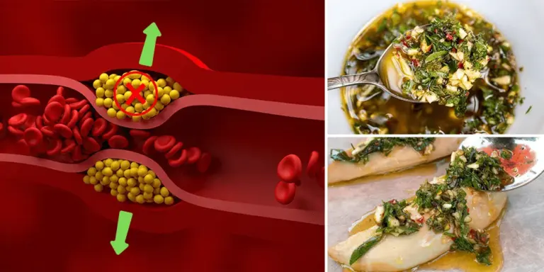 Cholesterol: Pharmaceutical Companies Bet on ‘s Lesser-Known Form, Lp(a)