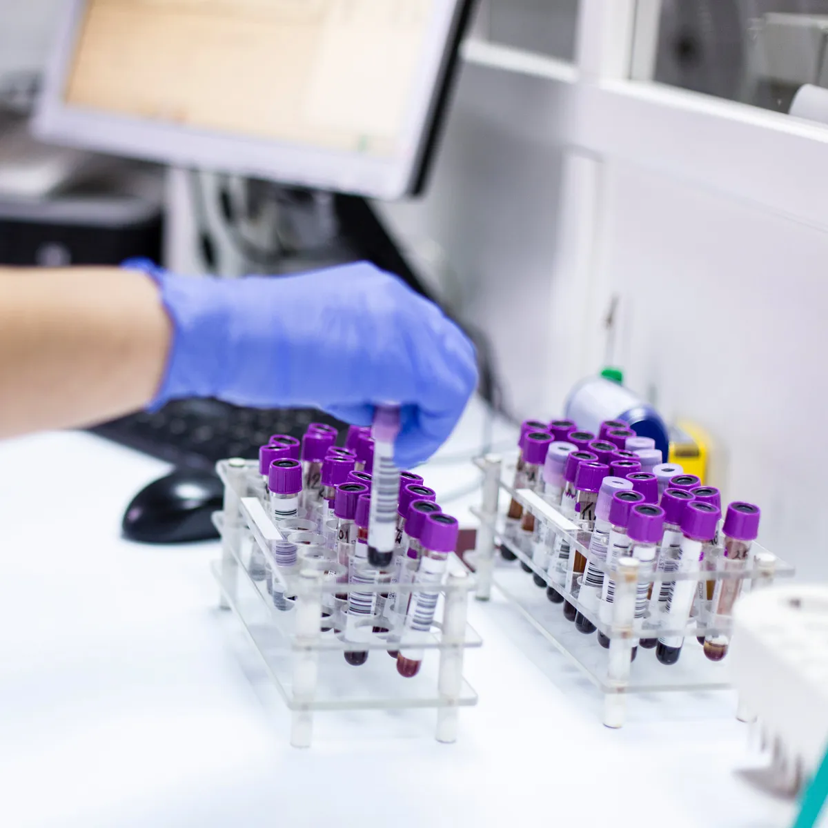 Colorectal cancer increasingly affects young adults in Switzerland
