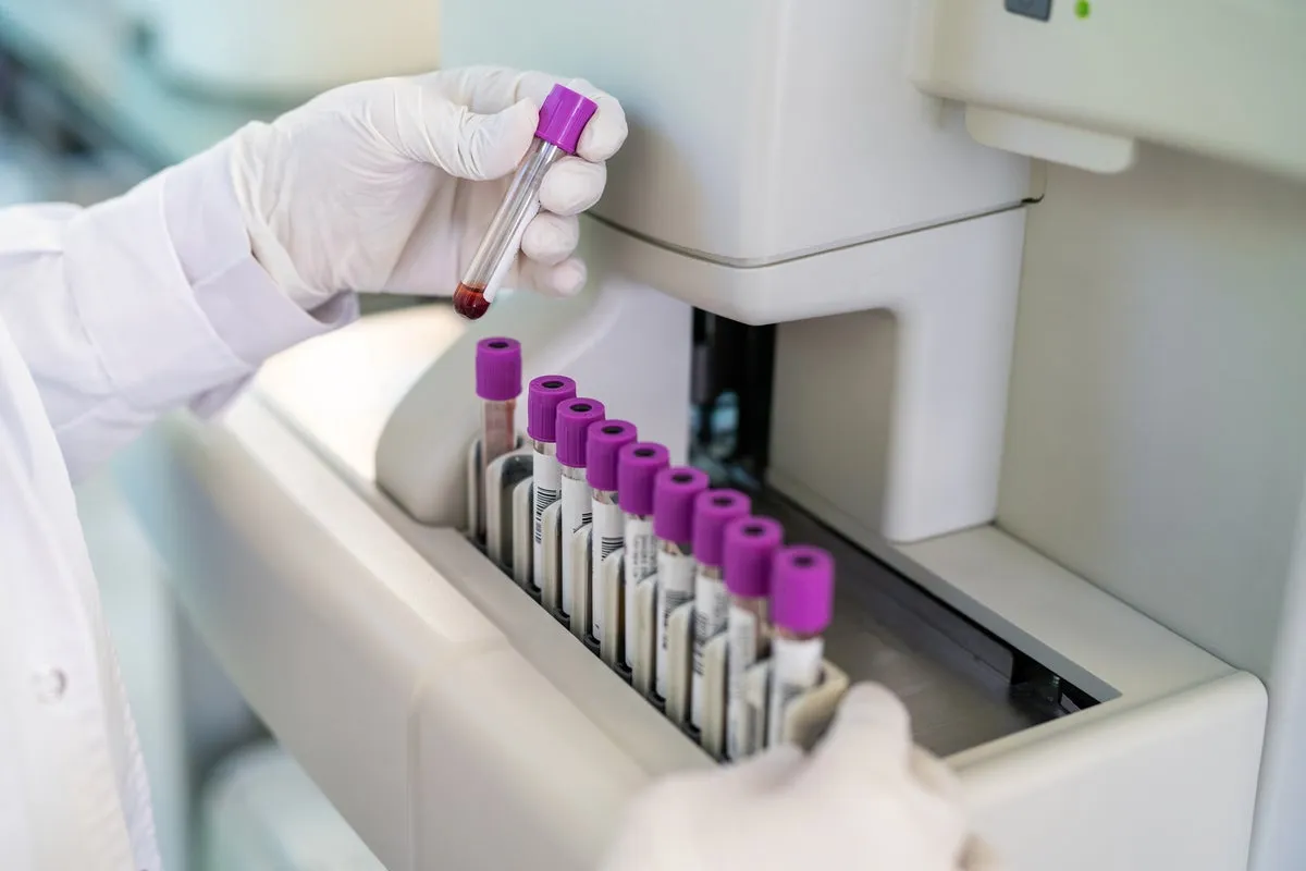 Heart Health: New Treatments for Lipoprotein(a)
